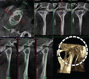 あごの骨・関節の診断 CT画像